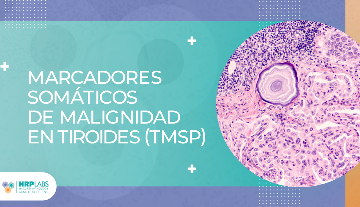 Marcadores somáticos de malignidad en tiroides (TMSP)