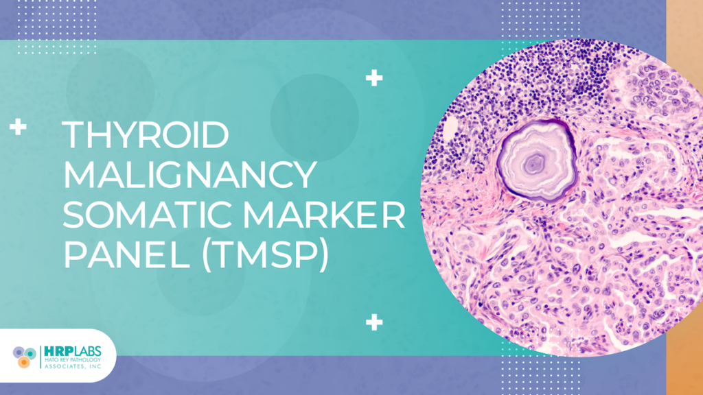 Thyroid Malignancy Somatic Marker Panel (TMSP)