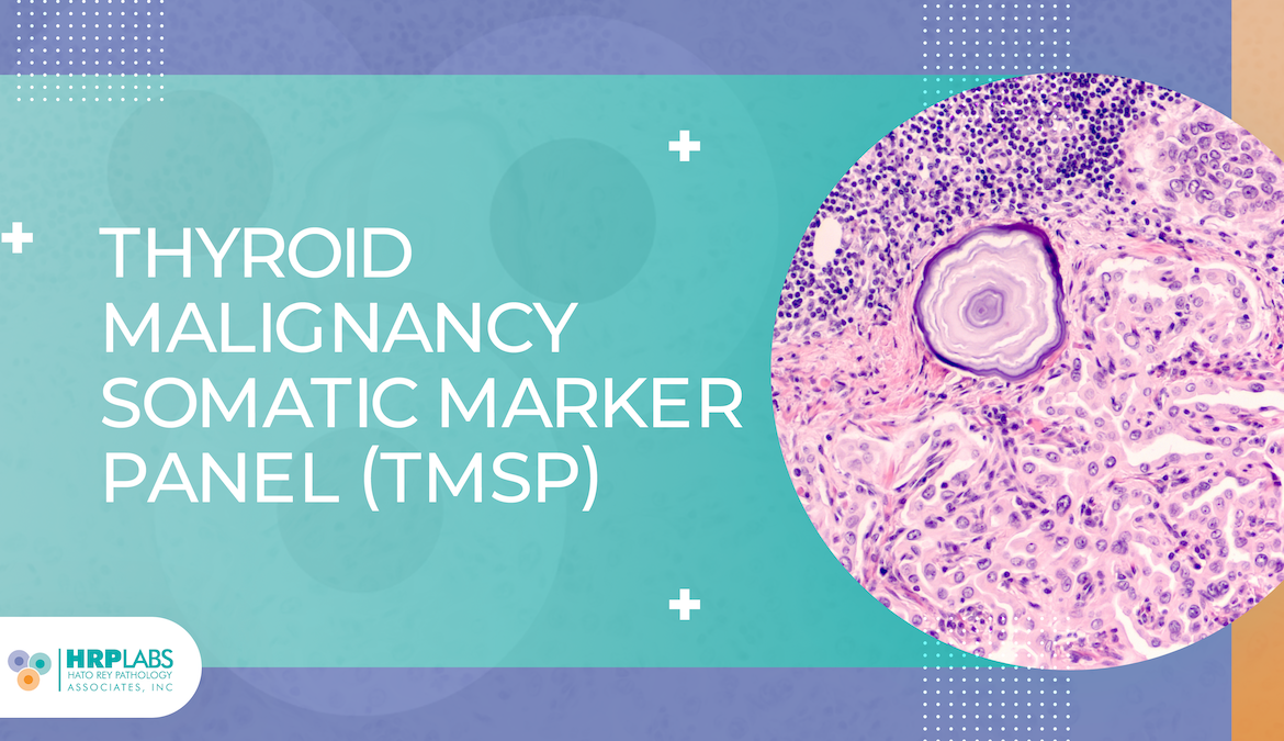 Thyroid Malignancy Somatic Marker Panel (TMSP)