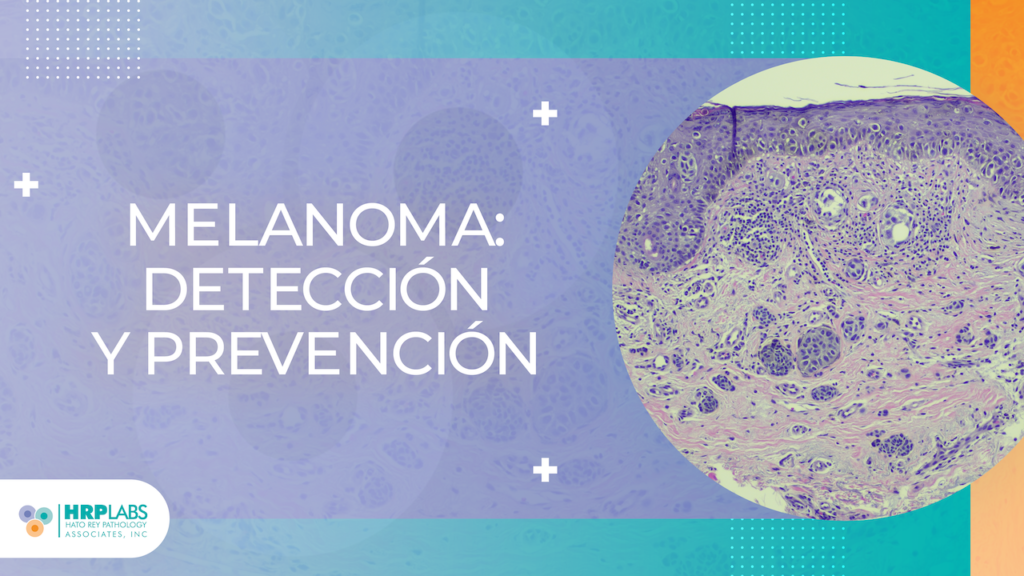 Melanoma: Detección y prevención