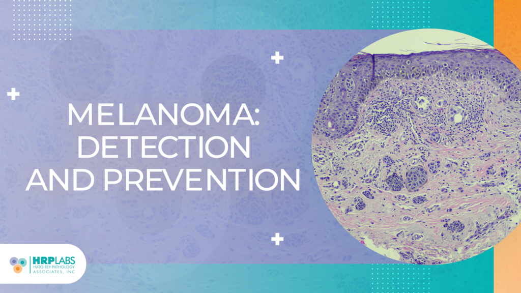 Melanoma: Detection and Prevention