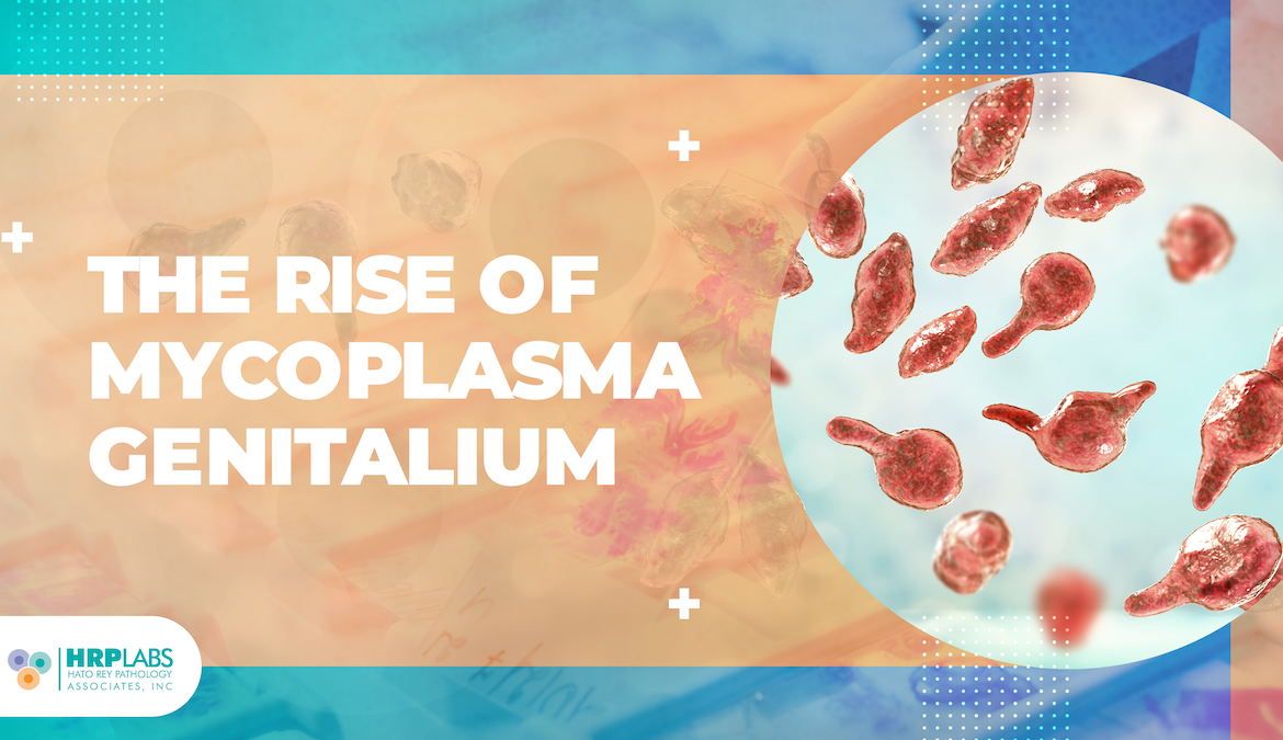 The Rise of Mycoplasma Genitalium