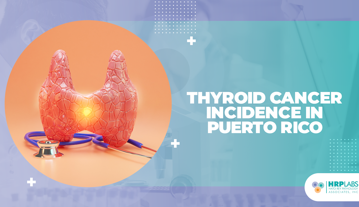 Thyroid Cancer Incidence in Puerto Rico