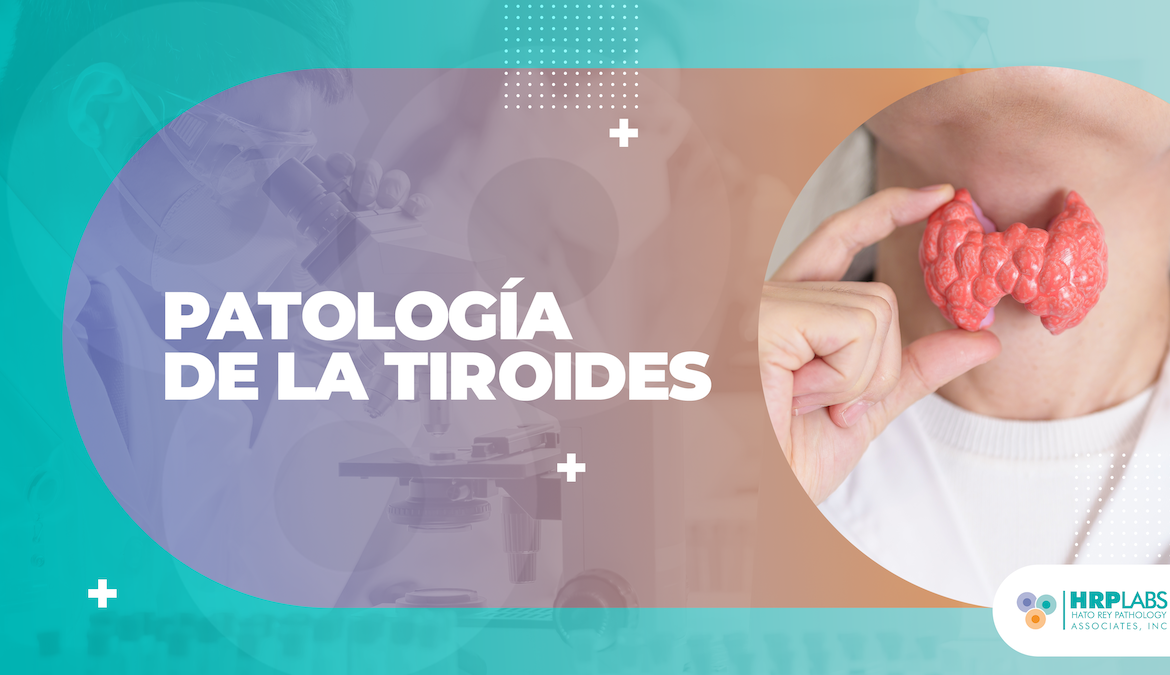 Patología de la Tiroides