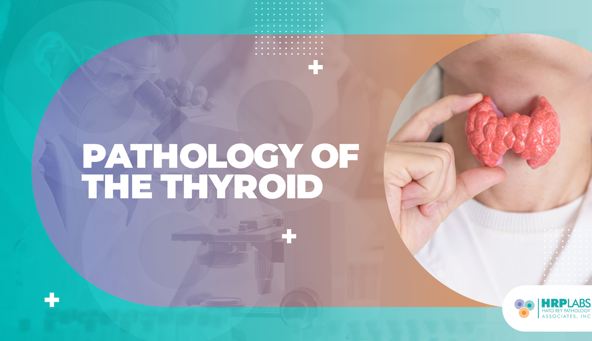 Pathology of the Thyroid