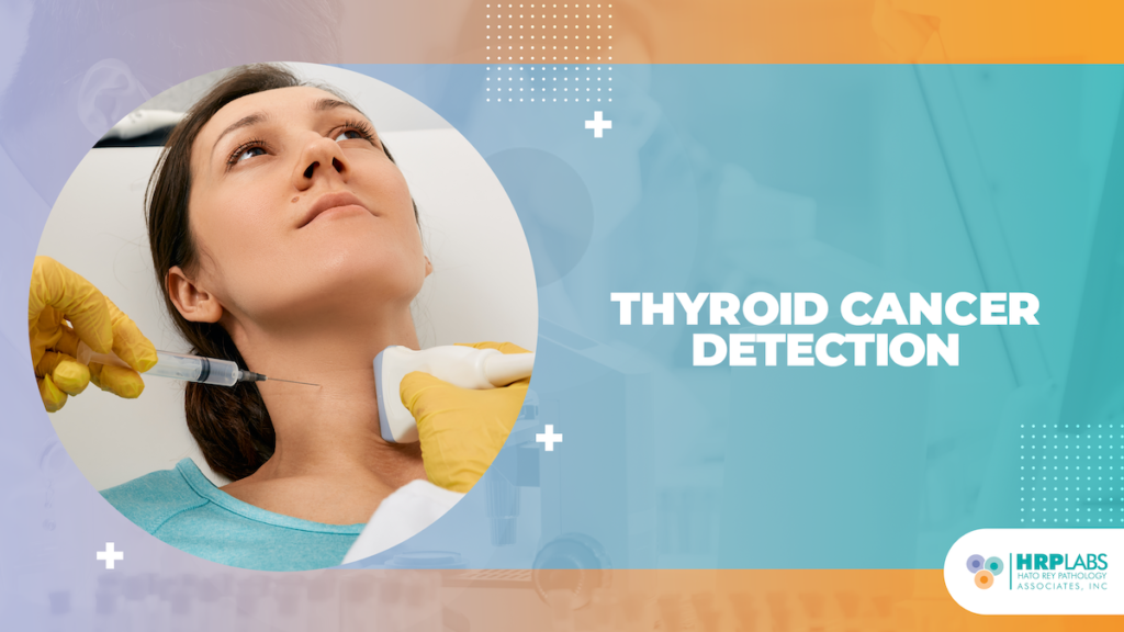 Thyroid Cancer Detection