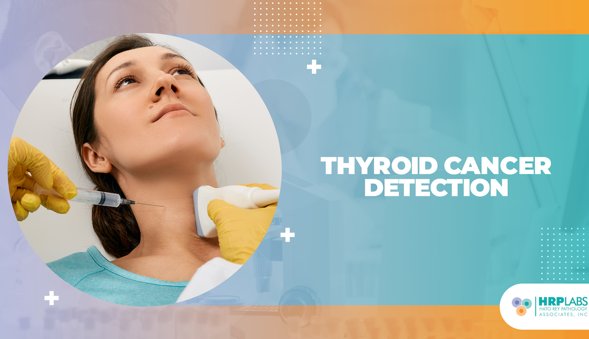Thyroid Cancer Detection