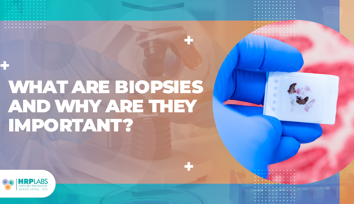 What are biopsies and why are they important?
