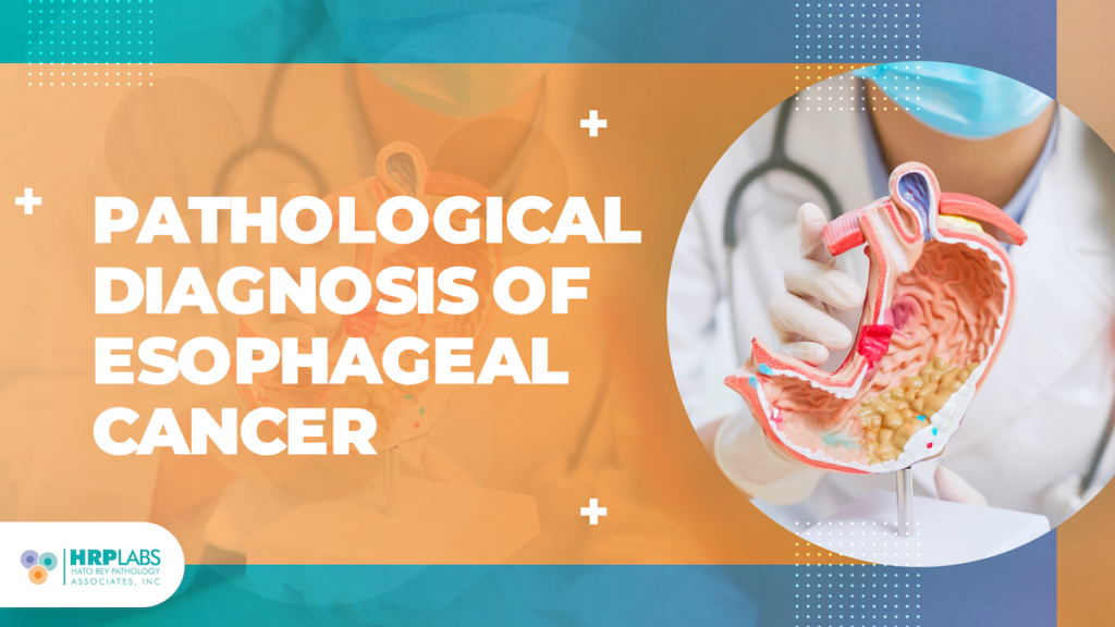 Pathological Diagnosis of Esophageal Cancer