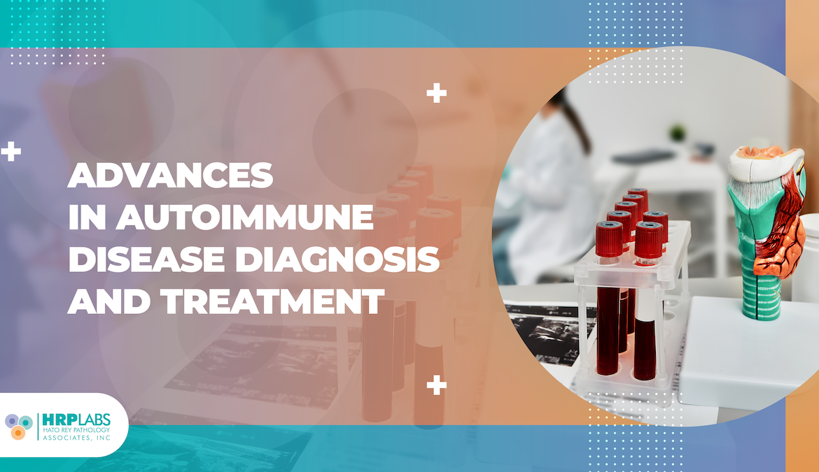 Advances in diagnosis and management of autoimmune diseases: Techniques and therapeutic strategies