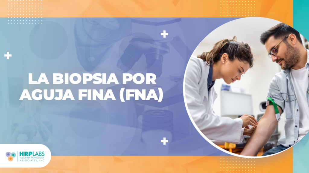 La Biopsia por Aguja Fina (FNA)