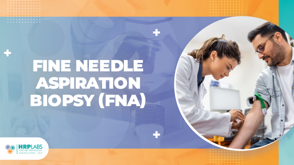 Fine Needle Aspiration Biopsy (FNA)