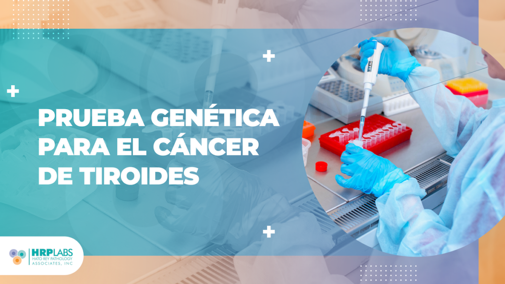 Prueba genética para el cáncer de tiroides