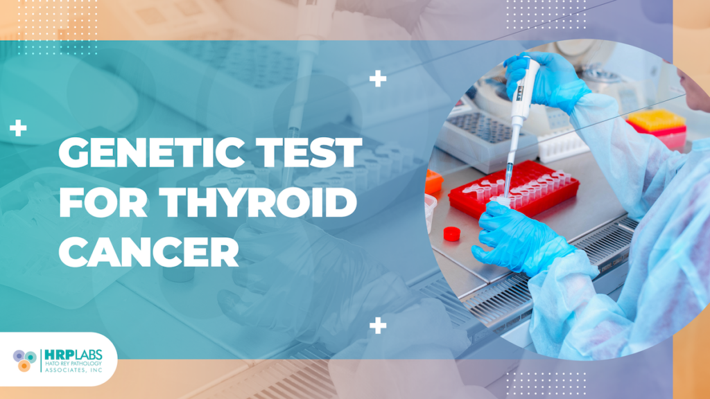 Genetic test for thyroid cancer