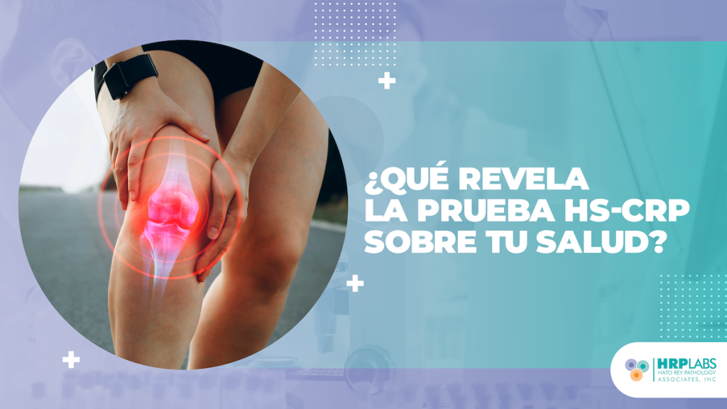 ¿Qué revela la prueba hs‑crp sobre tu salud?