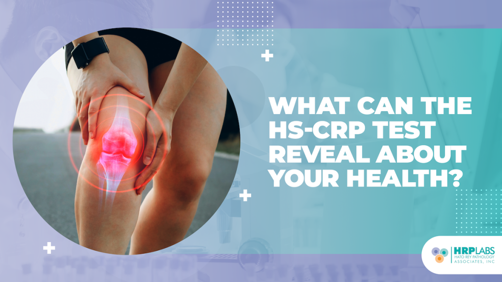 What can the hs-crp test reveal about your health?