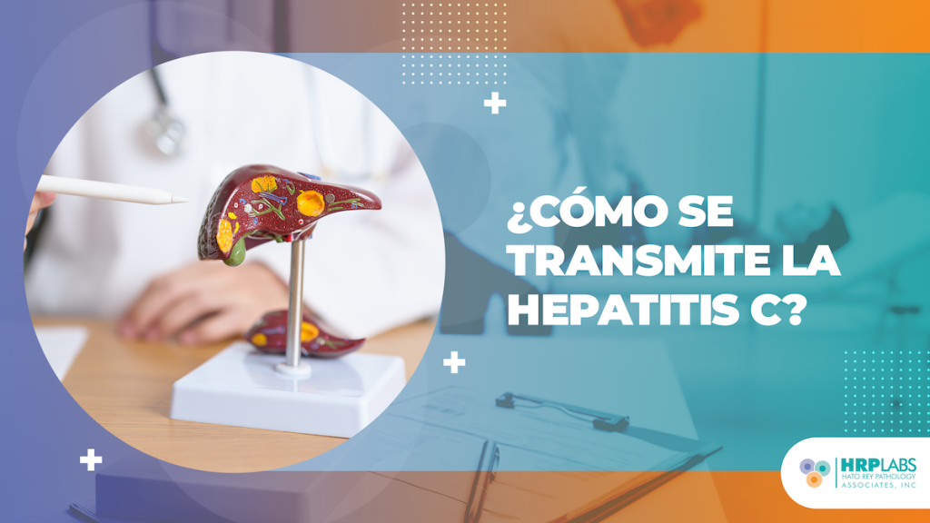 ¿Cómo se transmite la Hepatitis C?