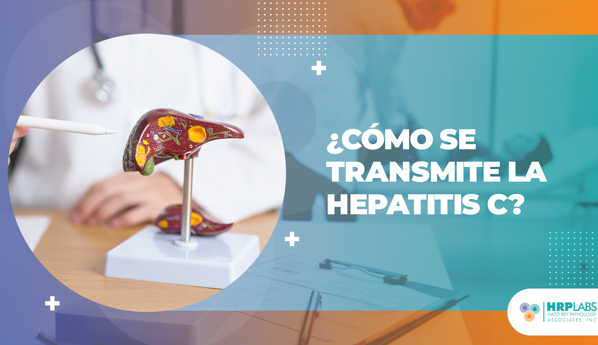 ¿Cómo se transmite la Hepatitis C?