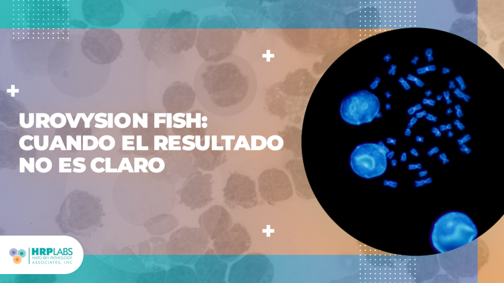 UroVysion FISH: cuando el resultado no es claro