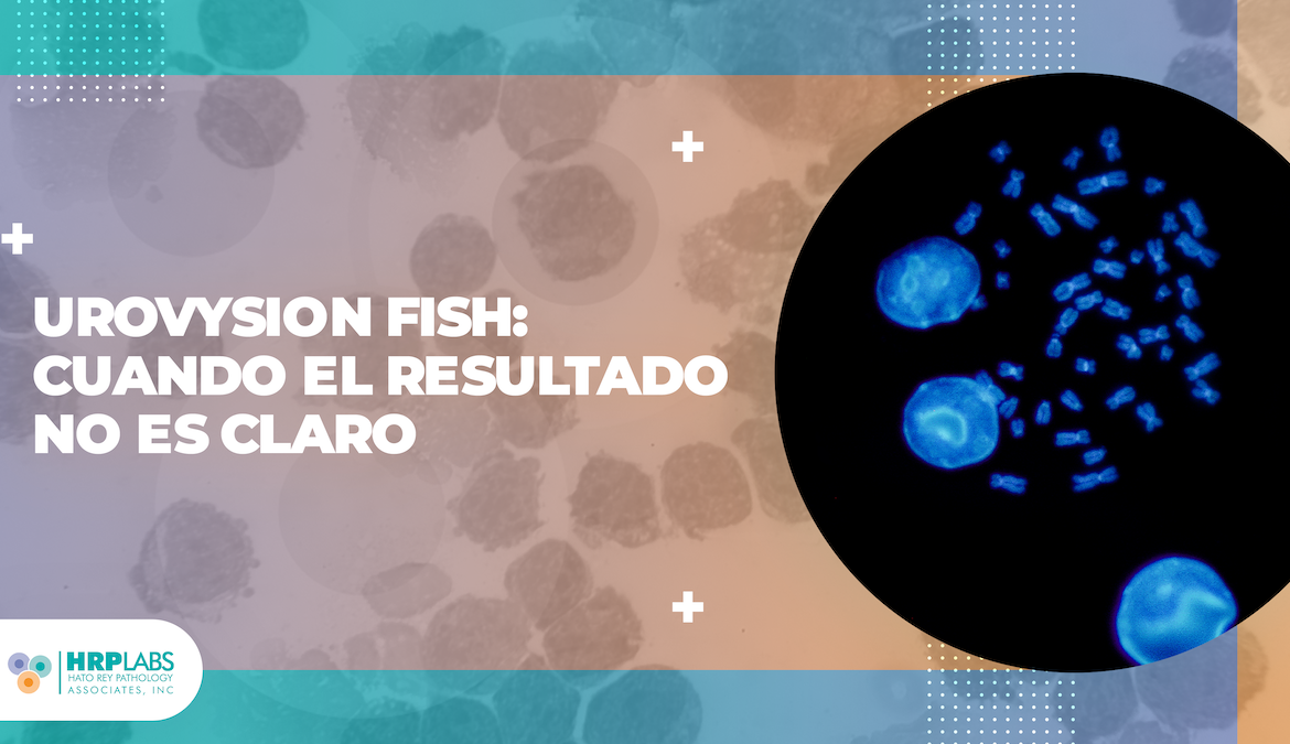 UroVysion FISH: cuando el resultado no es claro