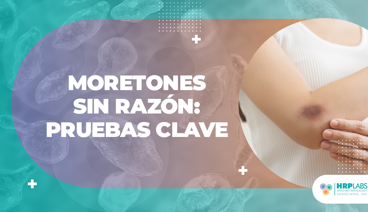 Moretones sin razón: pruebas clave