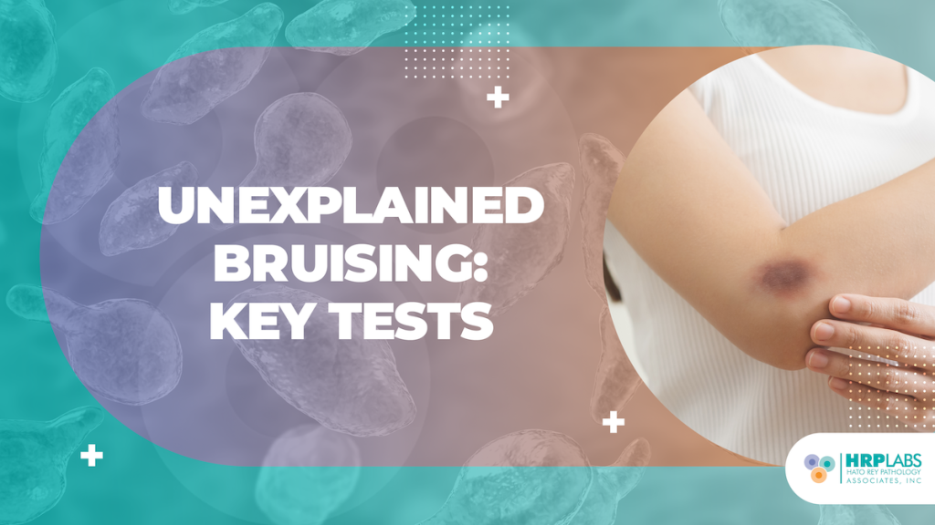 Unexplained Bruising: Key Tests
