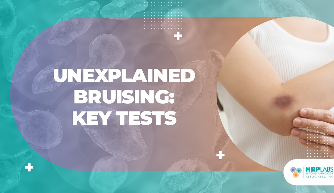 Unexplained Bruising: Key Tests