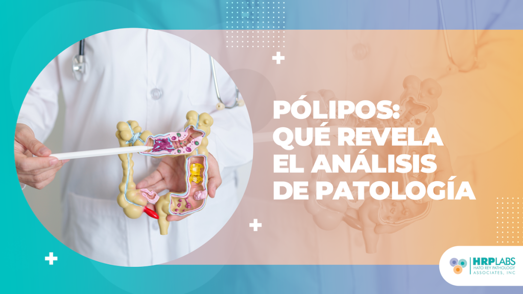 Pólipos: qué revela el análisis de patología