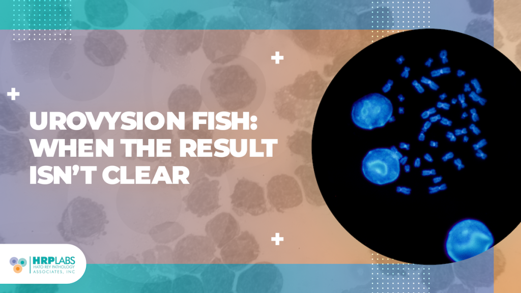 UroVysion FISH: When the Result Isn’t Clear
